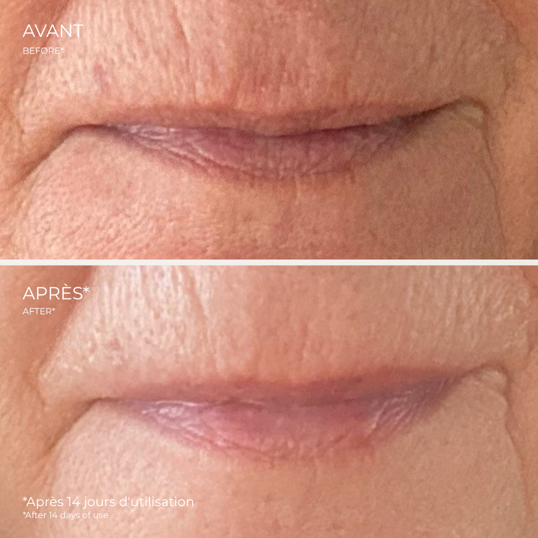 Eye &amp; Lip Contour Cream | Hydra Lift - Zorah biocosmétiques
