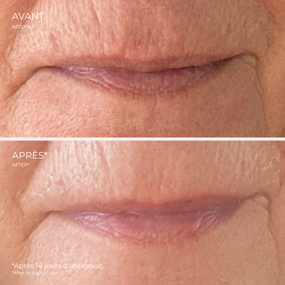 Eye &amp; Lip Contour Cream | Hydra Lift - Zorah biocosmétiques