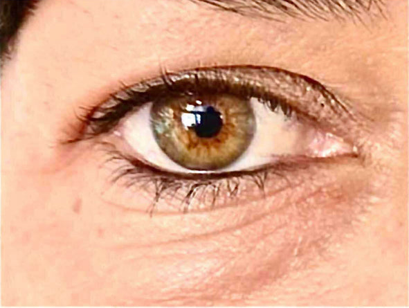Instant lifting effect eye contour patch