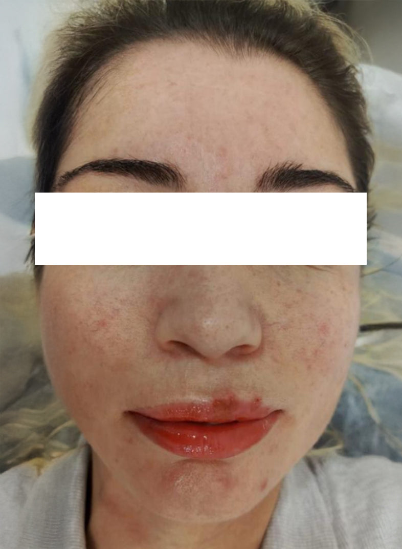 bioretinol | anti-dark spots night cream